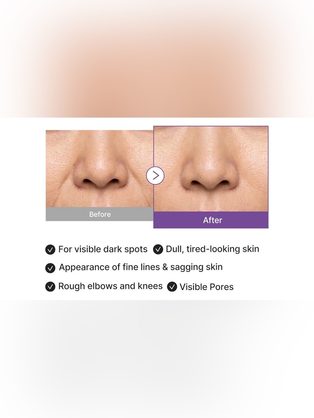 medicube Retinol Boosting Serum 1.9% – Purple - Picture 3 of 7